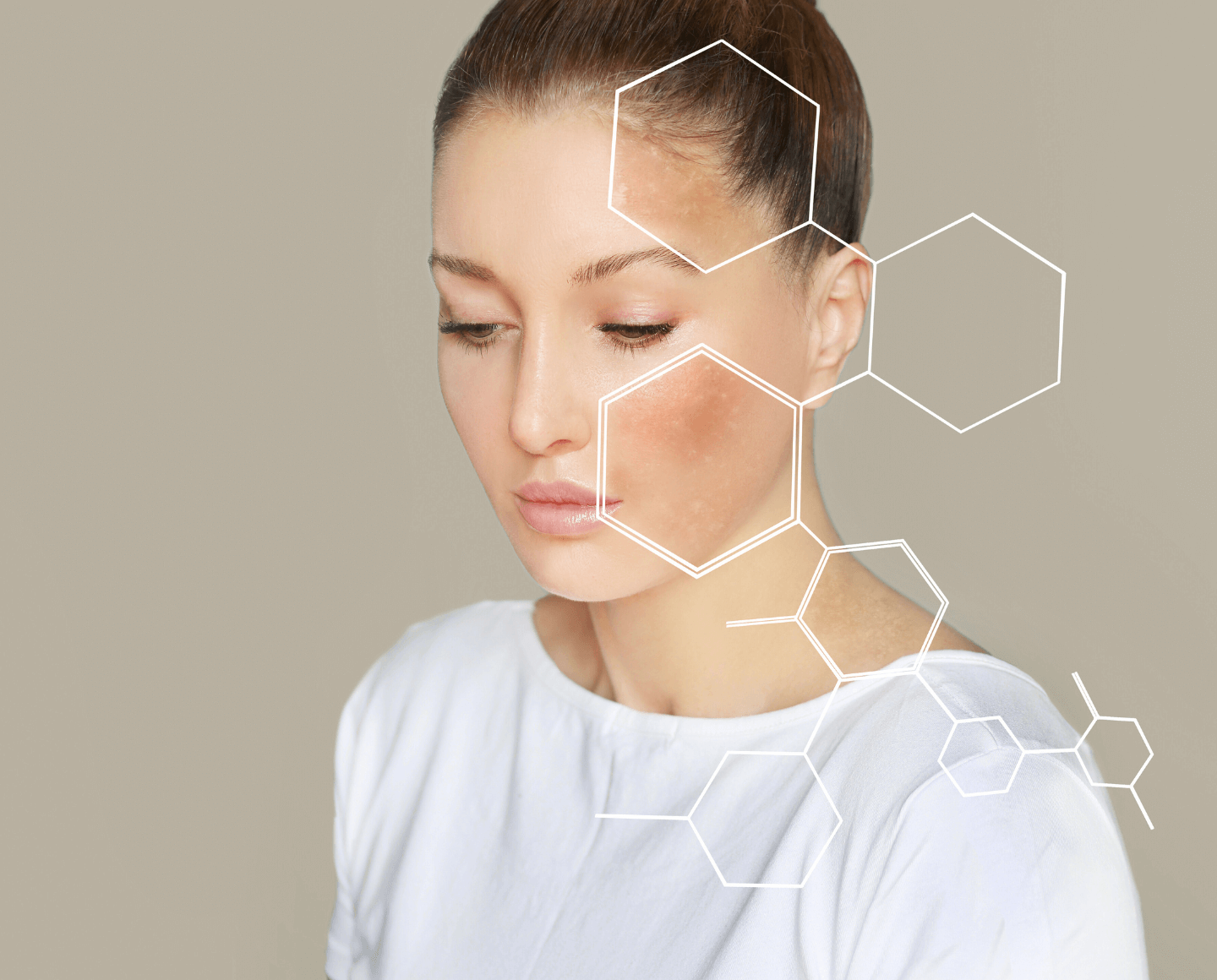 Common Bacterial Skin Infections & How Colloidal Silver May Help Naturally