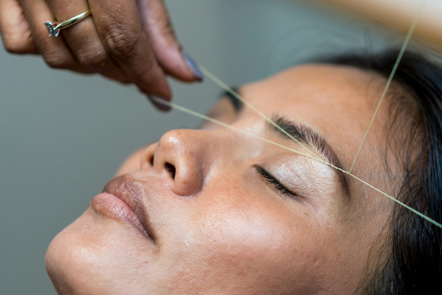 Why Do Professionals Use Aloe Vera Hydrogel for Post-Treatment Skin Care?